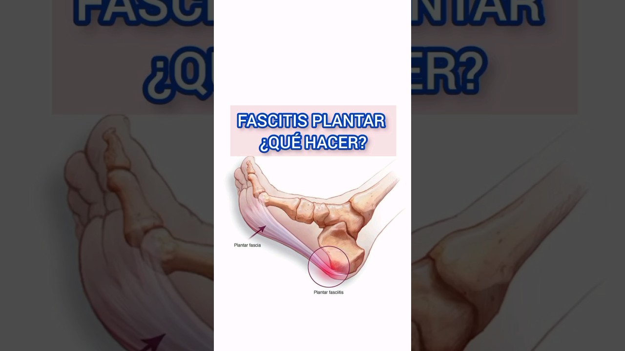 Cómo aliviar el dolor de huesos en la planta del pie